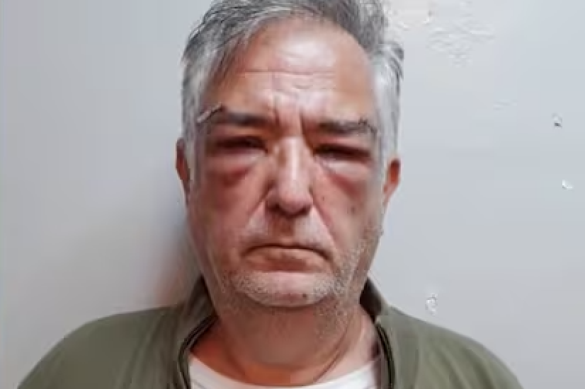 Miguel Calvete sin un solo pelo de sonso